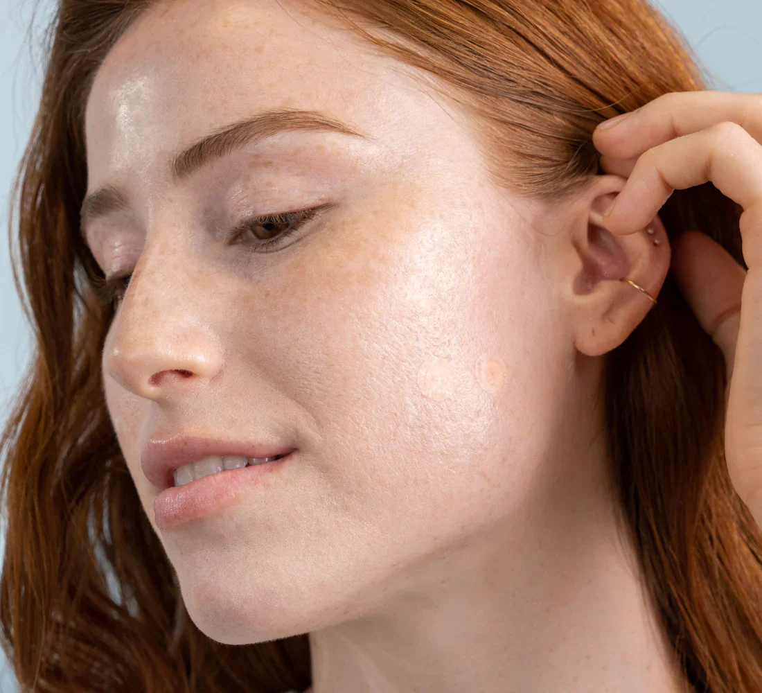 DermaDot Invisible Acne Patches - Image 2