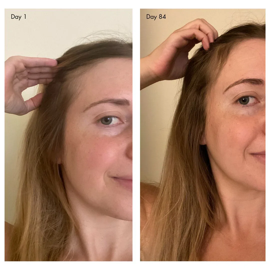 holi (growth) 84 advanced leave-in scalp and hair treatment - Image 3