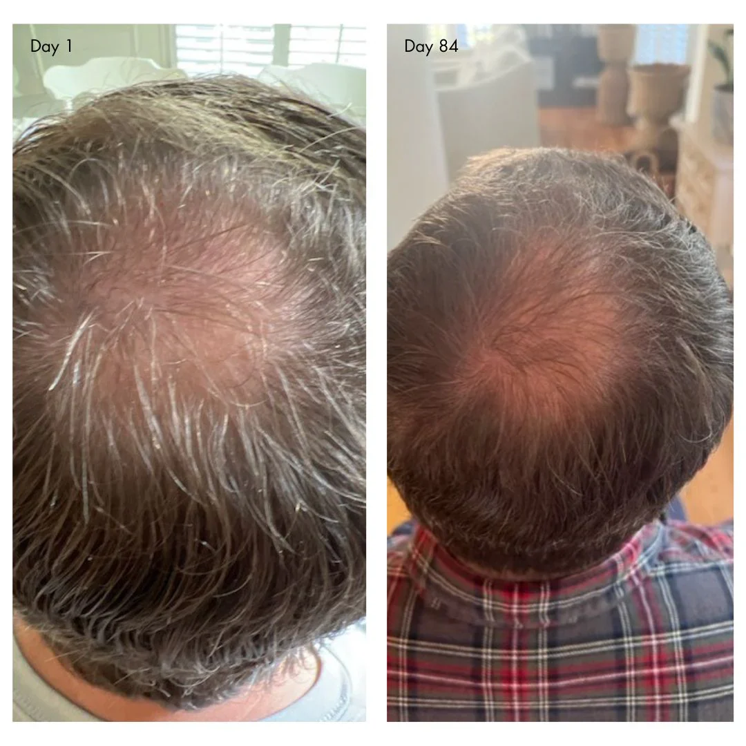 holi (growth) 84 advanced leave-in scalp and hair treatment - Image 4