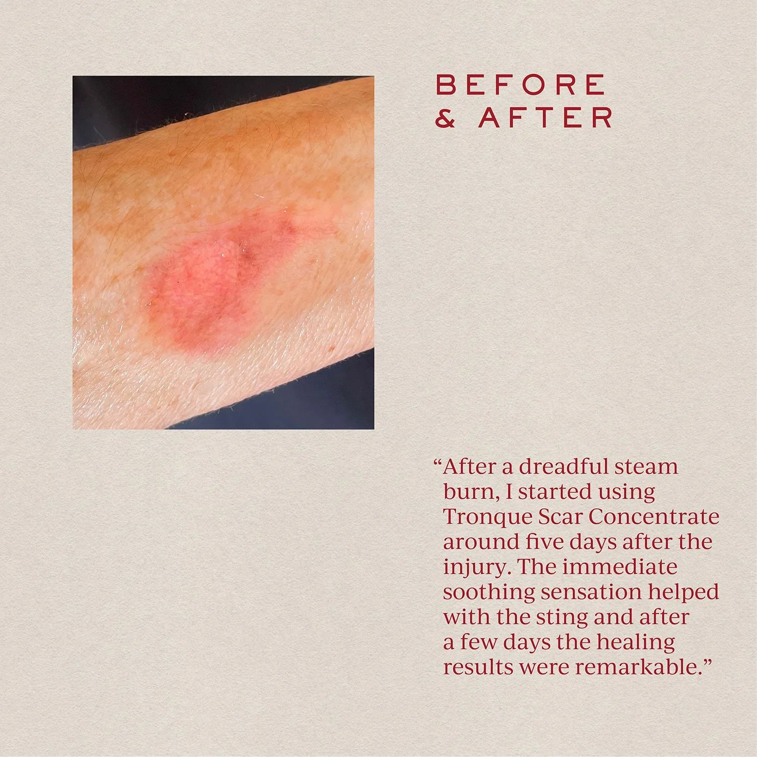 SOFT FOCUS Scar Concentrate - Image 3