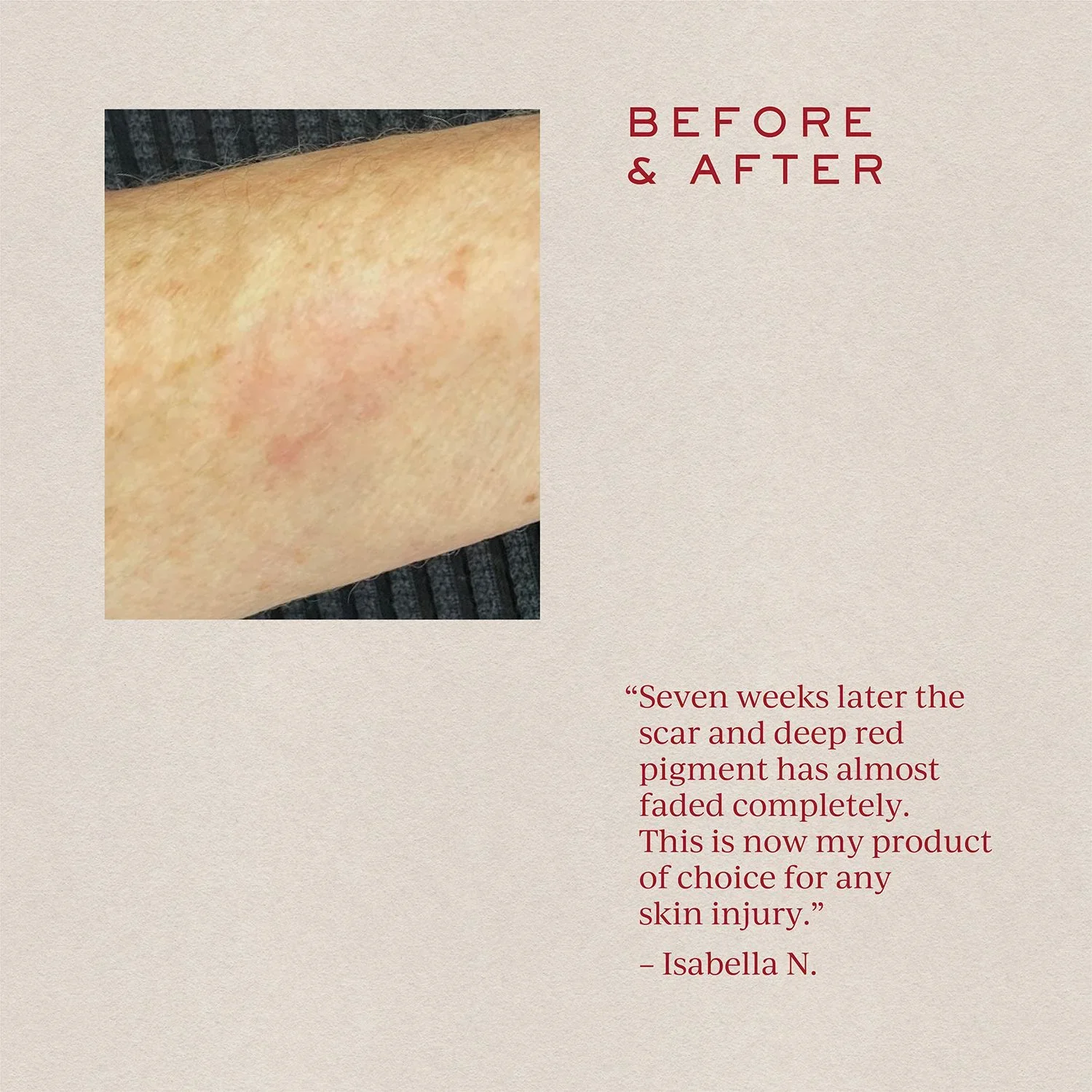 SOFT FOCUS Scar Concentrate - Image 4